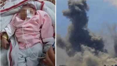 نتيجة صواريخ إسرائيلية جديدة، ولادة طفلة 