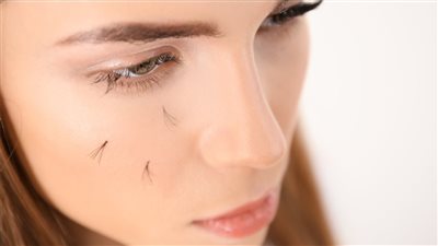 أسباب تساقط الرموش وطرق العلاج