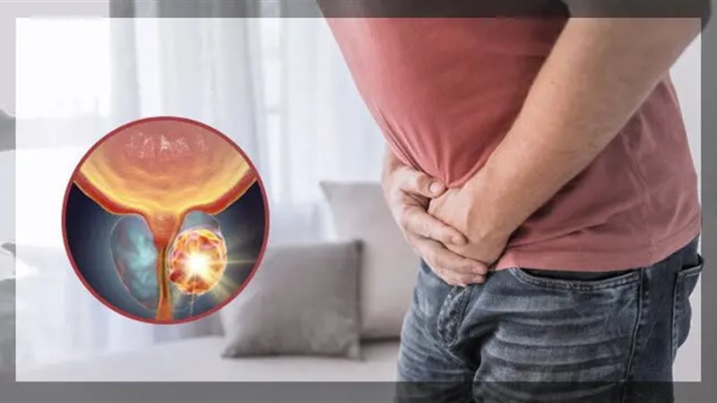 تضخم البروستاتا،