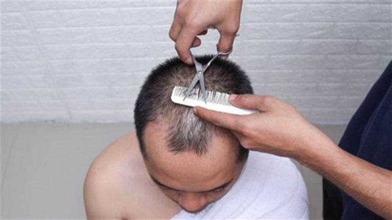 حكم تقصير الشعر للحاج،