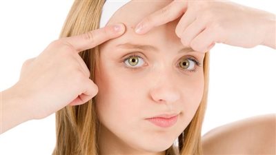 أبرزها العسل والقرفة، أفضل الوصفات الطبيعية للتخلص من حبوب الجبهة