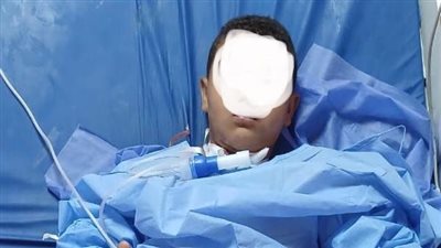 مستشفى سوهاج الجامعي ينقذ حياة طفل بعد اختراق سيخ معدني للرقبة والفك 