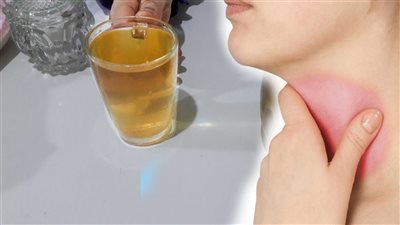 مفعولها سريع وآمن، علاج احتقان الزور بالوصفات الطبيعية