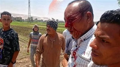  وزير الزراعة يزور مسؤول حماية الأراضي بسوهاج المعتدى عليه خلال تنفيذ قرار إزالة 