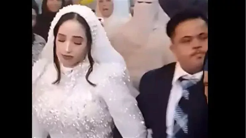 عريس مصاب بمتلازمة
