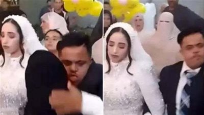 التحقيقات في واقعة عريس متلازمة داون: الزواج تم بعقد عرفي في حضور الأهل 
