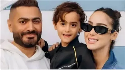 انفجار في الزائدة، تطورات الحالة الصحية لنجل تامر حسني 