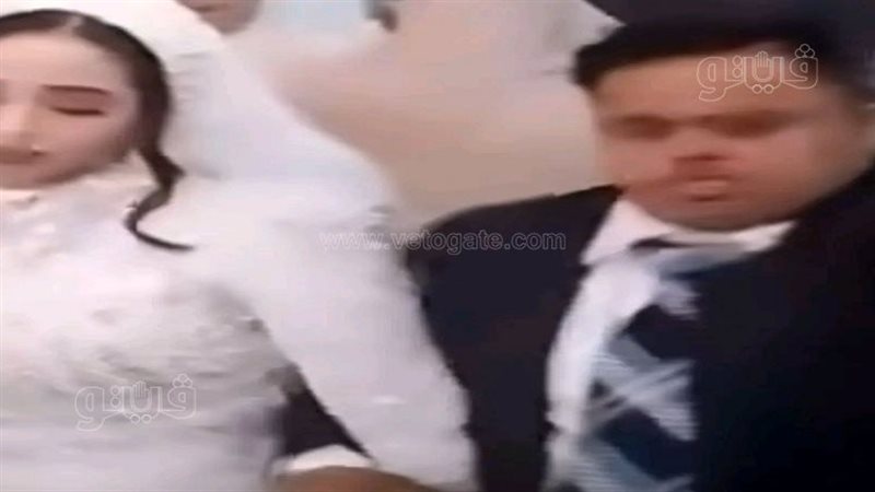  زواج شاب مصاب بمتلازمة