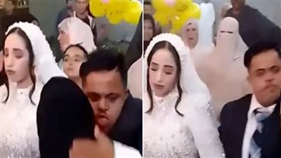 القومي للطفولة يكشف موقفه من زواج مصاب بمتلازمة دوان بعروس الشرقية