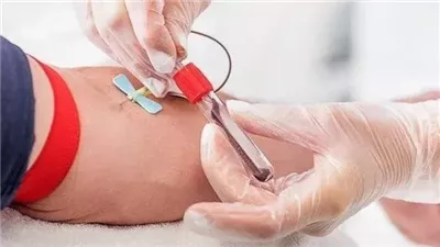 الهلال الأحمر يوضح شروط التبرع بالدم 