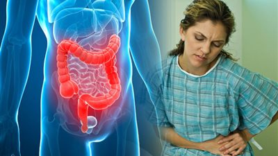 6 علاجات منزلية للتخلص من أعراض القولون العصبي