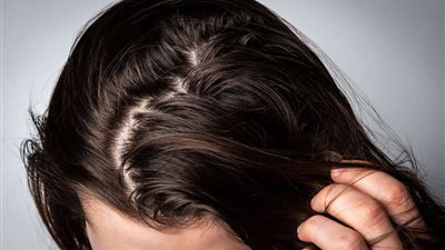 لحمايته من الجفاف، واقي شمس طبيعي للشعر خلال فصل الصيف