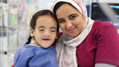 رئيس جامعة القناة يشيد بجهود قافلة الأمل عقب إجراء 34 جراحة تجميل دقيقة للأطفال (صور) 