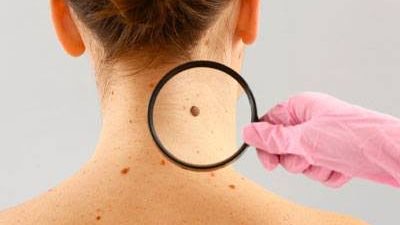 هيئة الدواء تحذر من الأعراض الجانبية لعقار 