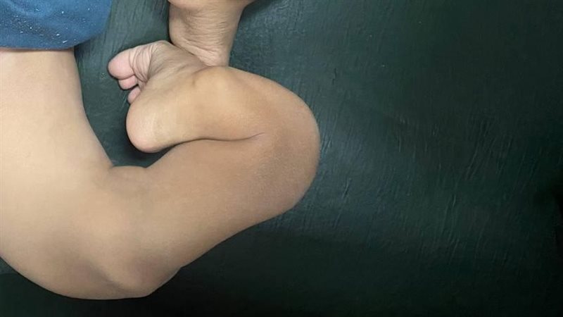 جزء من تشوهات الشاب،