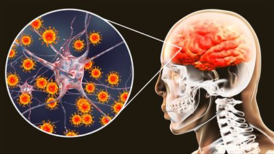 وفاة الطفل الرابع بسبب الالتهاب السحائي بالمنيا