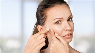 علاج حبوب الوجه والجبهة الناتجة عن الحر بالوصفات الطبيعية