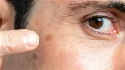 قناع طبيعي لتفتيح البقع الداكنة بالبشرة وزيادة جمالها 