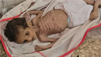 المرصد الأورومتوسطي: وفاة 1200 مسن في غزة بسبب المجاعة والآلاف مهددون بالموت 