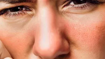 قناع طبيعي لتخفيف تأثير حرارة الطقس على البشرة 