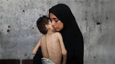 مجمع الشفاء بغزة يجدد تحذيره من ارتفاع عدد وفيات المجاعة بين الأطفال والمسنين