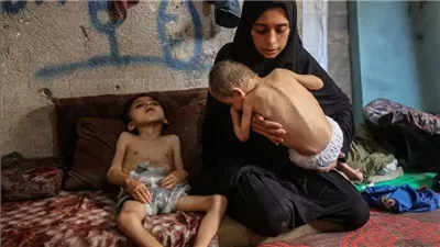 الصحة العالمية: استشهاد 421 شخصا في غزة بسبب سوء التغذية بينهم 113 طفلا عام 2025 