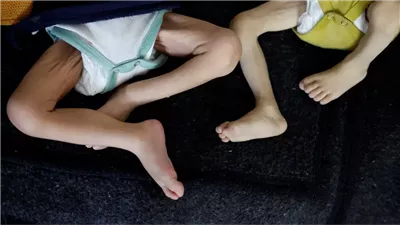 بينهم 114 طفلا، ارتفاع حصيلة ضحايا المجاعة في غزة لـ 281 شهيدا 