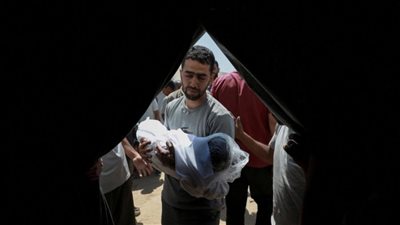 استشهاد 8 فلسطينيين نتيجة المجاعة وسوء التغذية خلال الـ24 ساعة الماضية