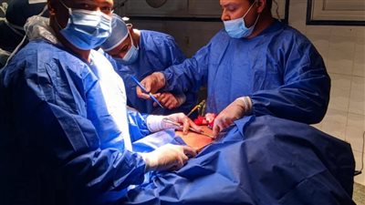 إنقاذ مسنة من مضاعفات انسداد القولون الكاذب في مستشفى قنا العام