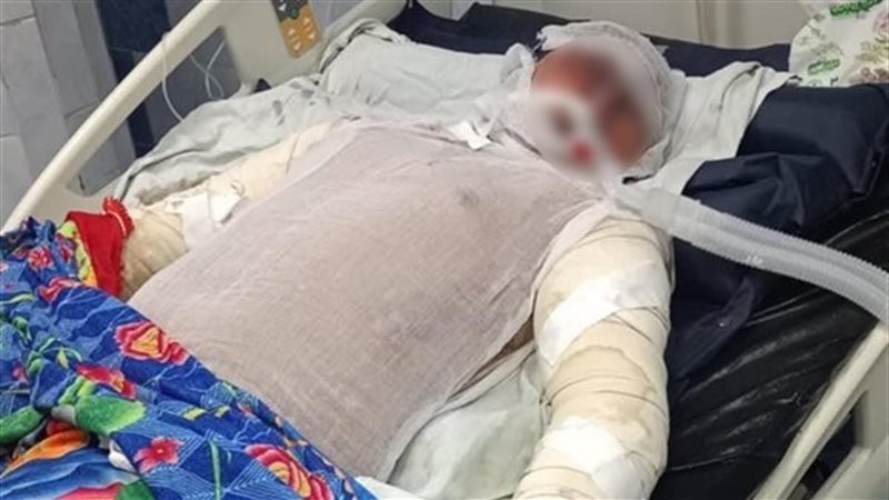 وفاة بطل حريق شبرا