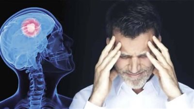 أعراض جلطة المخ وأسباب الإصابة بها 