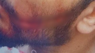 أول تعليق من نقابة الأطباء بشأن الاعتداء على طبيب امتياز بمستشفى سيد جلال