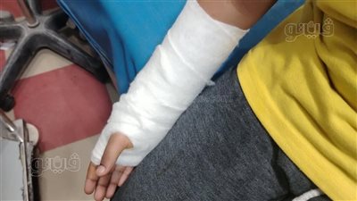 ولي أمر بالمنوفية يحرر محضرًا ضد شاب من ذوي الهمم اعتدى على ابنه في الشارع