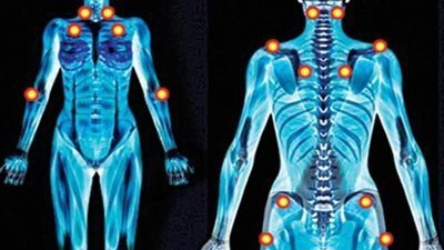 أسباب الفيبروميالجيا وأعراضه ومخاطر الإصابة به