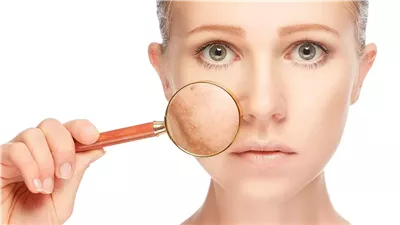 ودعي بقع الشمس.. روتين طبيعي فعال لتفتيح البشرة وعلاج التصبغات