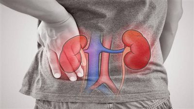 أنواع الفشل الكلوي وأعراضه وطرق التشخيص