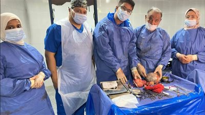 نجاح جراحة معقدة لمريضة أورام بمستشفى قنا العام 