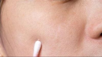 طرق بسيطة تخلصك من البثور البيضاء بالبشرة 