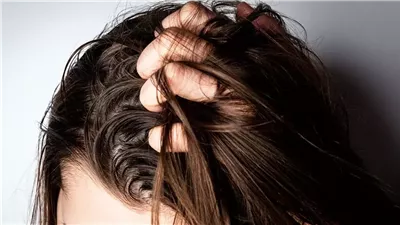 نصائح مهمة تساعدك فى العناية بالشعر الدهني 