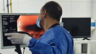 صحة الشرقية تدعم مستشفى حميات الزقازيق بمنظار حديث 