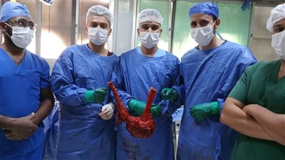 استئصال ورم يزن 7 كيلو من قولون مريض بمستشفى الفيوم العام