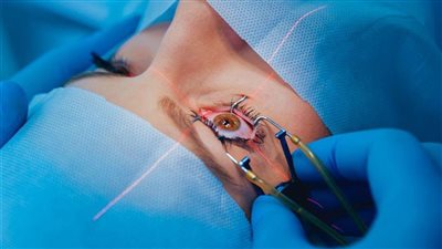 ربة منزل من الفيوم تتهم مركزا لعلاج العيون بالتسبب في فقد بصرها