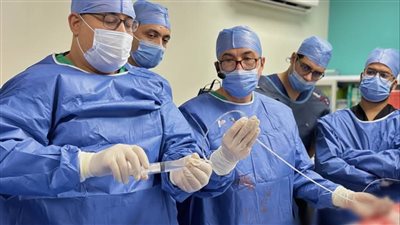 إجراء 12 جراحة لتوسيع الصمام الميترالي بالبالون بمجمع الإسماعيلية الطبي (صور)