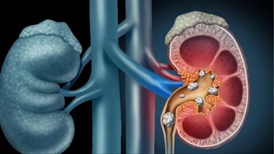 توصلوا إلى مفتاح القتل، 