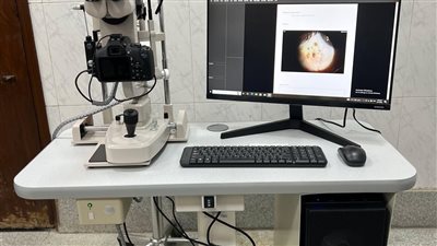 وحدة أورام العيون بقصر العيني تقدم خدمات تشخيص وعلاج متكاملة بالمجان