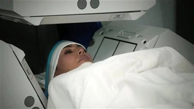 بعد إصابة كيم كارداشيان بالمرض، ما هو تمدد الأوعية الدموية الدماغية وأعراضه؟ 