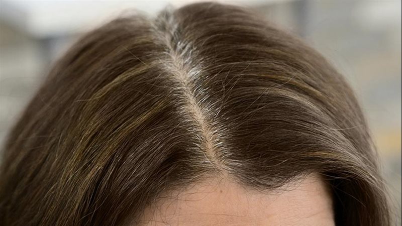 مخاطر تغطية الشعر