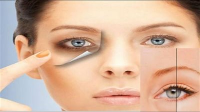 خلطات طبيعية، للتخلص من الهالات السوداء حول العين