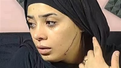 موعد محاكمة المتهمة بتشويه عروس مصر القديمة بـ 41 غرزة 