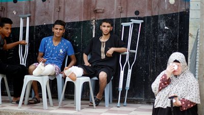 سنغافورة تتبرع بأطراف صناعية للفلسطينيين مبتوري الأطراف فى قطاع غزة